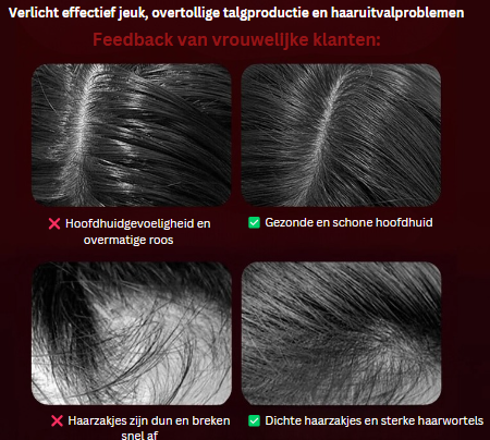 Haar Herstellende Massageborstel